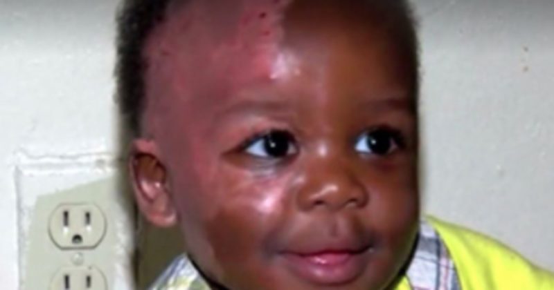 14930506276017 800x420 1479733166 Baby Suffers Horrific Burns And His Daycare Didn't Even Call For Help