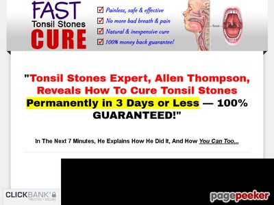 1505378988 d41d8cd98f00b204e9800998ecf8427e How to Cure Tonsil Stones