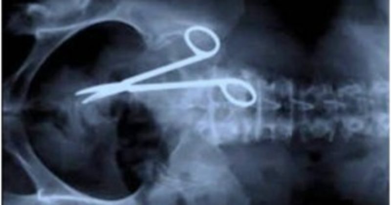 15120584852330 800x420 1497018254 15 Crazy X-Ray Photos That Will Make You SO Thankful You're Not A Doctor