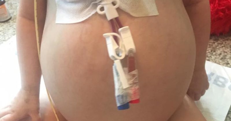 15146504772359 800x420 1498053092 This Tiny Girl Looked Pregnant, But The Truth Had Her And Dad Going Under The Knife
