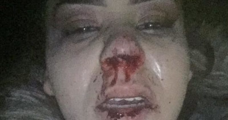 15206984982668 800x420 1484571313 Heartbreaking Images Show That Domestic Abuse Can Happen To Anyone