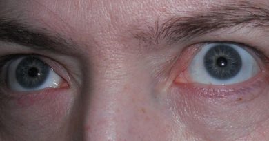 15294248764630 800x420 1482436586 8 Ways Your Eyes Are Trying To Tell You About Your Health